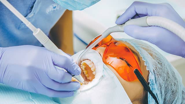 Διαδικασία λεύκανσης δοντιών στο οδοντιατρείο